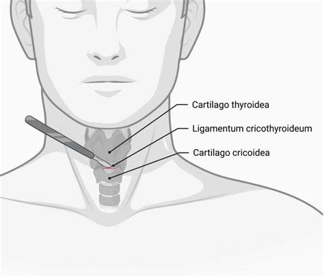 Ligamentum Cricothyroideum Medianum Doccheck Flexikon