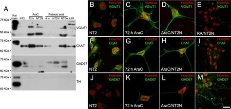 A Western Blot Analysis Of Neurotransmitter Phenotype Markers In