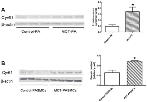 Expressions Of Cyr61 In Pulmonary Arteries And Pulmonary Arterial