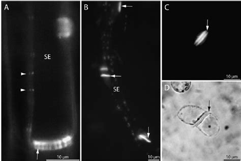 Detection of cell wall cellulose and callose using CW staining on ...