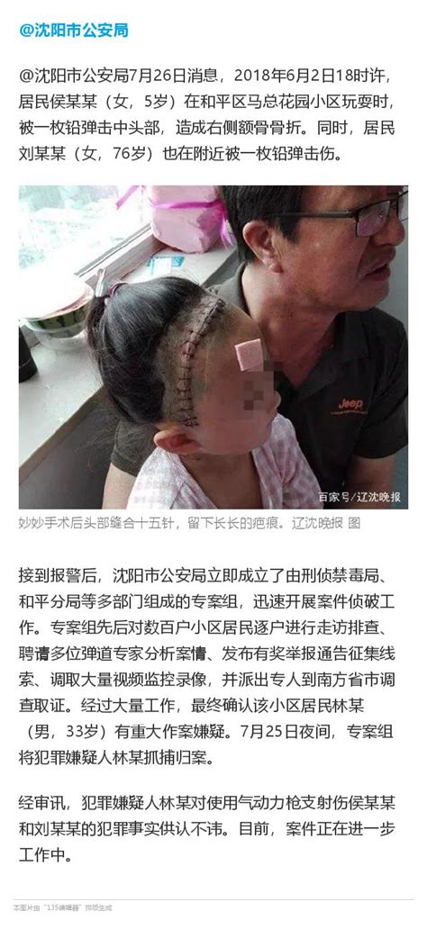 5歲女童小區內玩耍被鉛彈擊中頭部，嫌犯找到了 每日頭條