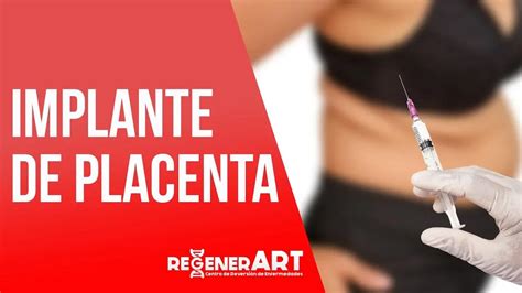 Implante De Placenta