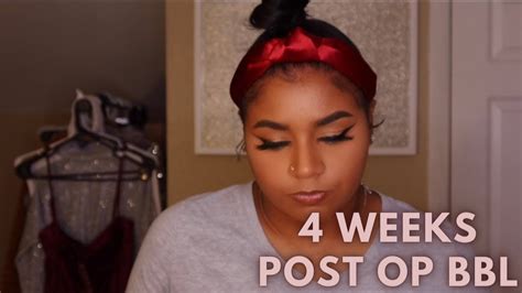 4 Weeks Post Op Bbl Update And Qanda Recovery Home And Flight Experience