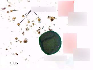 Heterosporous - Vascular Plants Diagram | Quizlet