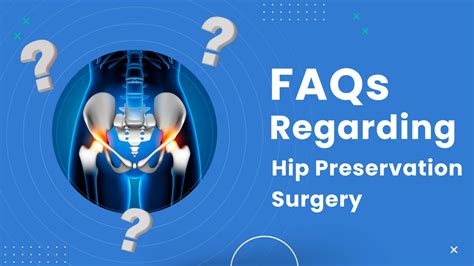 Hip Preservation Surgery Questions And Answers Dr Nk Magu