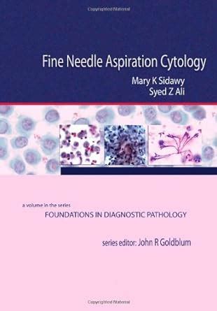 Fine Needle Aspiration Cytology A Volume In Foundations In Diagnostic