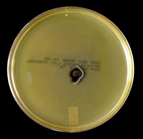 Fun With Microbiology What S Buggin You Fonsecaea Pedrosoi Monophora