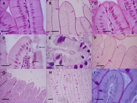 Light Micrographs Of Rabbit Duodenal Mucosa Showing The Effect Of