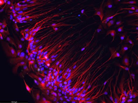 Bipolar Neuron Microscope