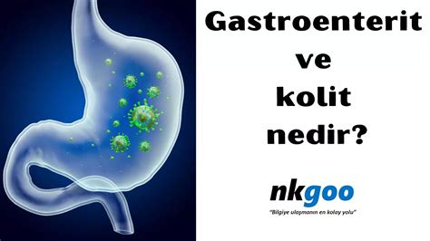 Gastroenterit Ve Kolit Nedir Belirtisi Nedeni Nkgoo