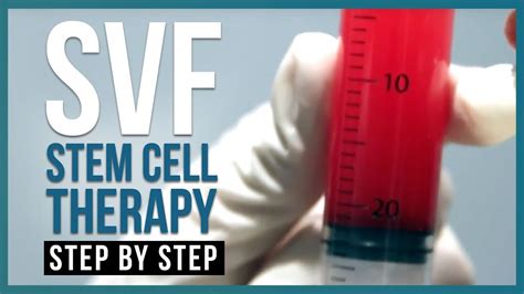 Stromal Vascular Fraction Stem Cell Therapy Svf Therapy Step By