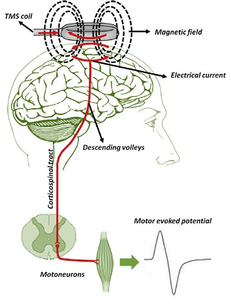 Schematic Representation Of Transcranial Magnetic Stimulation Tms