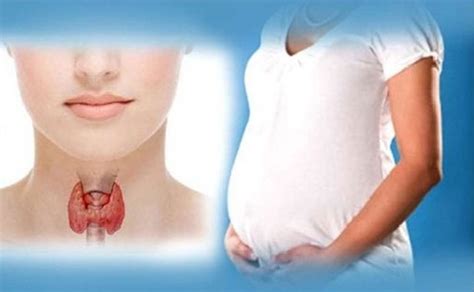 Thyroid problem treatment | Thyroid weight gain treatment |Thyroid disease