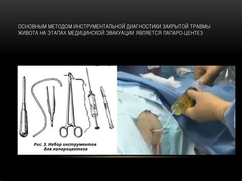 Закрытая травма живота - презентация онлайн