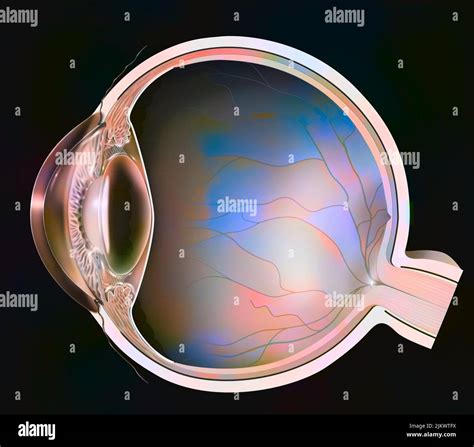 Anterior Sub Capsular Cataract Hi Res Stock Photography And Images Alamy