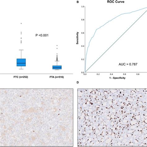 Ki 67 Labeling Index In Follicular Thyroid Carcinomas Ftc And Download Scientific Diagram