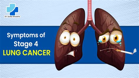 Symptoms Of Stage 4 Lung Cancer Dr Sudip Shrestha