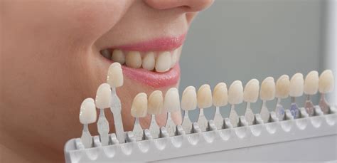 Orofacial Como Clarear Os Dentes Maneiras Infal Veis Para O