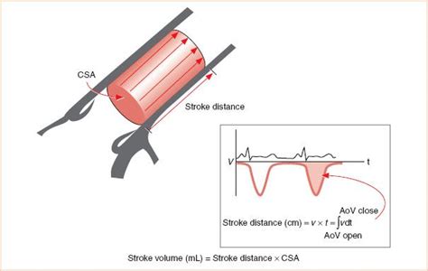 Quantitative Doppler And Hemodynamics Radiology Key