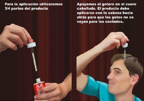 Tratamientos para la caída del cabello Veterini Salud Capilar