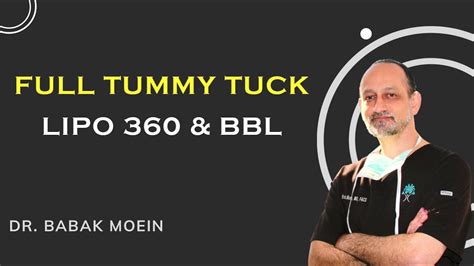 Full Tummy Tuck Abdominoplasty Before And After ️‍🔥 Liposuction 360