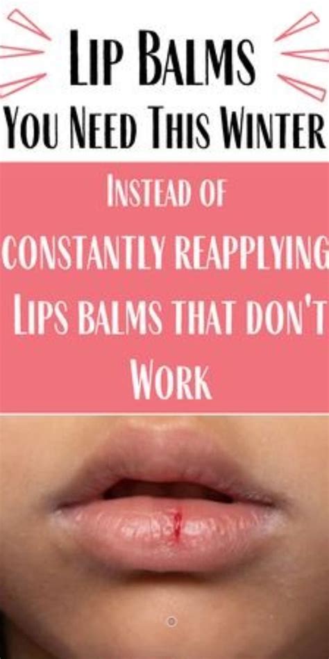 Effective Ways To Get Rid Of Chapped Lips Overnight Chapped Lips