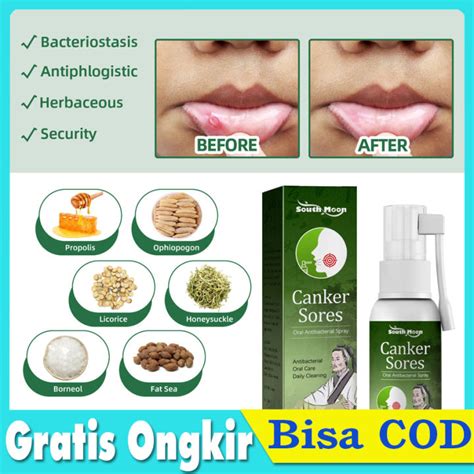 20ml Spray Mouth Ulcer Obat Sariawan Mulut Dewasa Paling Ampuh