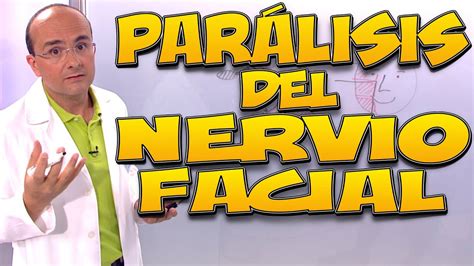 PARÁLISIS del NERVIO FACIAL Qué es CAUSAS tipos SÍNTOMAS