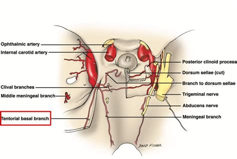 The Tentorium Cerebelli: A Comprehensive Review Including Its Anatomy ...