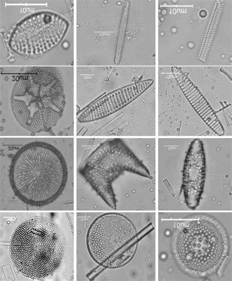 Diatoms Under Microscope Labeled