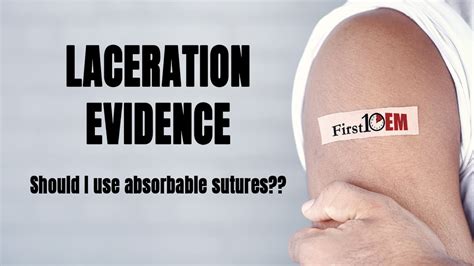 Laceration Evidence Absorbable Sutures Or Not First10em