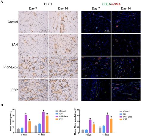 A IHC Staining Of CD31 Left And IF Staining Of CD31 And A SMA