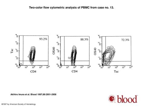 Ox40 Expressed On Fresh Leukemic Cells From Adult T Cell Leukemia