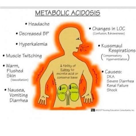 Pin On • Nursing School ‍• Nursing Mnemonics Nursing School Survival Metabolic Acidosis