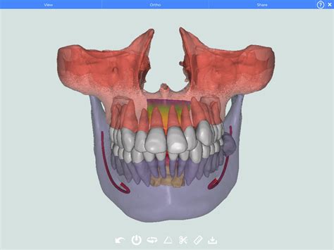 Cephalometric Analysis Teeth Segmentation Service Cephx