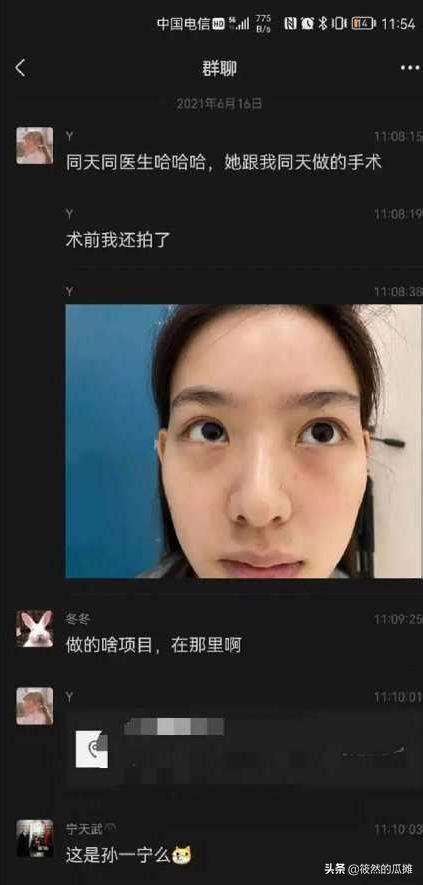 孫一寧舊照曝光，網友驚呼：王思聰跪舔的美女，竟也是「整容怪」 每日頭條