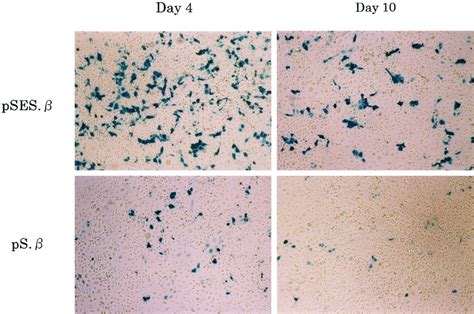 X Gal Staining