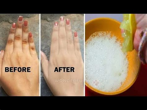 Days Challenge To Whiten Dark Knuckles Naturally At Home Remove