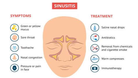 When To Go To ER For Sinus Infection? - Aether Health - Kingwood ER