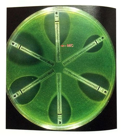 Etest – Ritu's Biology Hub