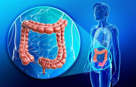 Fusobacterium Nucleatum Oral Bacteria Linked To Colon Cancer