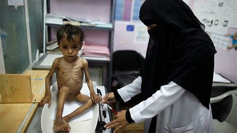 Un Yemen Could Face Famine In 2017 Over 2 3 Of Population In Urgent Need Of Aid — Rt World News