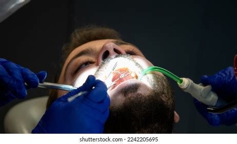 Tooth Decay Prevention Man Dentist Chair Stock Photo