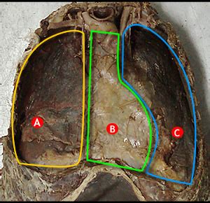 28 The Chest Wall And Pleura