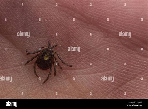 An Embedded Tick From Peru Ticks Are A Vectors Of Diseases Which