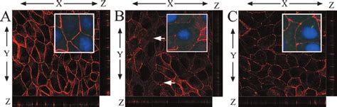 Egf Prevents C Jejuni Induced Disruption Of Tight Junctional