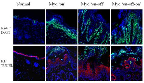 Immunohistochemical comparison of skin epidermis from... | Download ... 