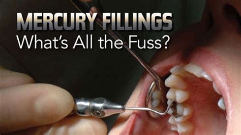 Holistic Dentistry: Mercury Amalgam - What's all the Fuss? | Hout Bay Dental Studio - Hout Bay ...