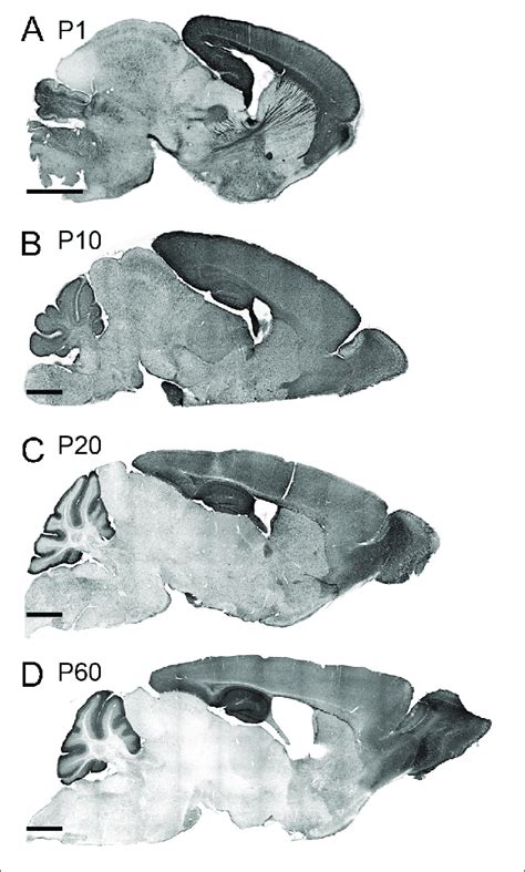 Tcf Expression Patterns Of The Neonatal And Juvenile Mouse Brain