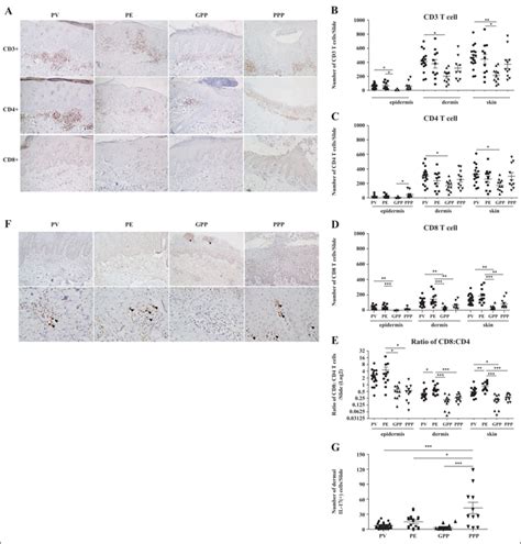 Jle European Journal Of Dermatology Correlation Of T Cell And Il 17 Cell Subsets In